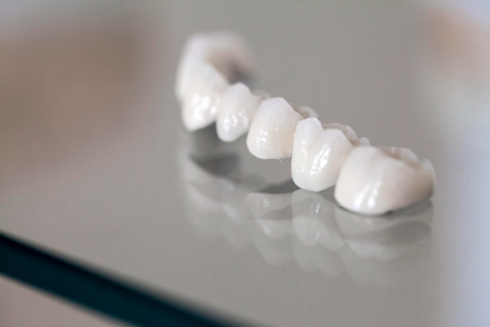 Dental Crowns & Bridges